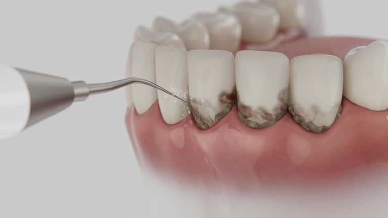 Trusted Tooth Extraction service in Cocoa, FL - Dentist Open Now